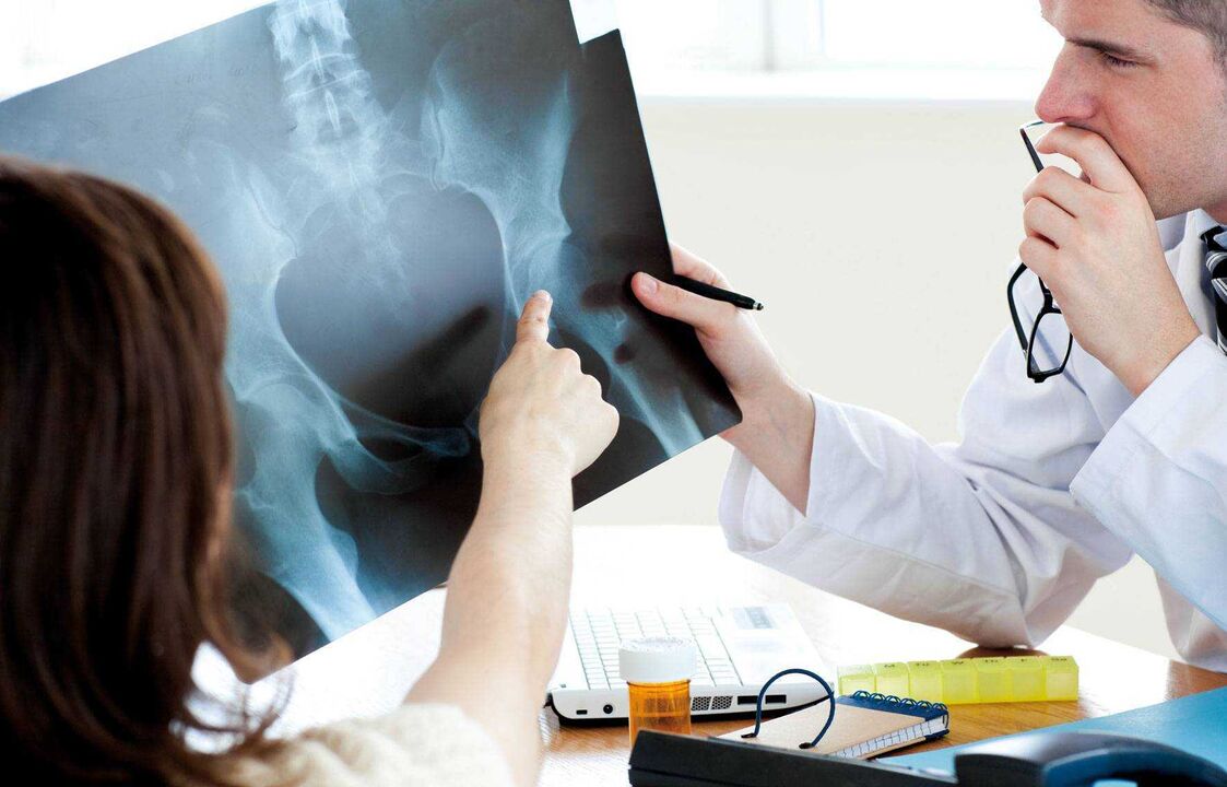 Doctors examine X-rays for arthrosis of the hip